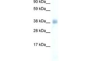 WB Suggested Anti-YY1 Antibody Titration:  0. (YY1 anticorps  (Middle Region))