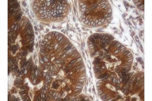 Image no. 1 for anti-IlvB (Bacterial Acetolactate Synthase)-Like (ILVBL) antibody (ABIN1498882) (ILVBL anticorps)