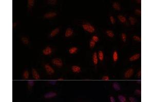 Immunofluorescence analysis of U-2 OS cells using WDR18 Polyclonal Antibody at dilution of 1:100. (WDR18 anticorps)