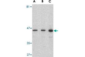 Western blot analysis of PSEN1 in human brain lysate with PSEN1 polyclonal antibody  at (A) 0. (Presenilin 1 anticorps  (C-Term))