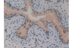 Detection of GLI3 in Mouse Vas Deferens Tissue using Polyclonal Antibody to GLI Family Zinc Finger Protein 3 (GLI3)