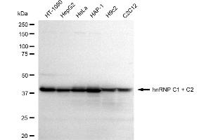 Western blotting analysis using hnRNP C1 + C2 antibody (ABIN7798896).