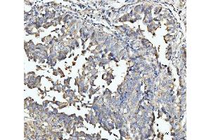 IHC analysis of ECSIT using anti-ECSIT antibody (ABIN7602543).
