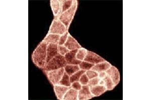 Immunostaining on MDCK cells