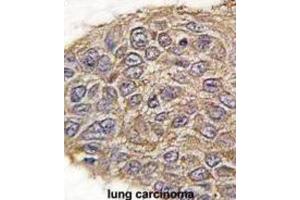 Immunohistochemistry (IHC) image for anti-Aldolase (ALD) antibody (ABIN3001589) (Aldolase anticorps)