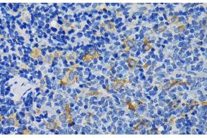 Immunohistochemistry of paraffin-embedded Rat spleen using IQGAP1 Polyclonal Antibody at dilution of 1:200 (40x lens). (IQGAP1 anticorps)
