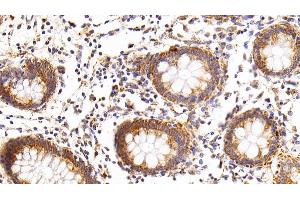 Detection of RNASE3 in Human Rectum Tissue using Polyclonal Antibody to Ribonuclease A3 (RNASE3)