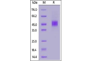 Mouse IL-2 R beta, His Tag on  under reducing (R) condition. (IL2 Receptor beta Protein (AA 27-240) (His tag))