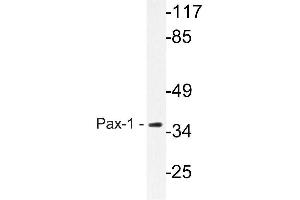 Western blot (WB) analysis of Pax-1 antibody in extracts from HeLa cells. (PAX1 anticorps)