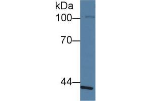 Western Blot; Sample: Human Lung lysate; ;Primary Ab: 1µg/ml Rabbit Anti-Human SLFN5 Antibody;Second Ab: 0.
