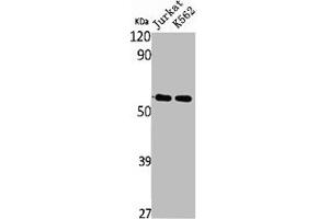 Western Blot analysis of Jurkat K562 cells using SS-56 Polyclonal Antibody (TRIM68 anticorps  (Internal Region))
