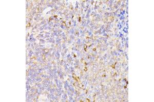Immunohistochemistry of paraffin-embedded rat spleen using PSMG1 antibody (ABIN7269593) at dilution of 1:100 (40x lens).