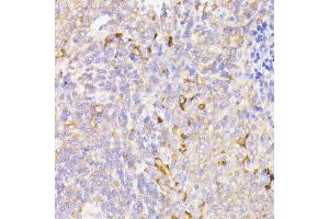 Immunohistochemistry of paraffin-embedded rat spleen using PSMG1 antibody (ABIN7269593) at dilution of 1:100 (40x lens). (PSMG1 anticorps  (AA 1-288))
