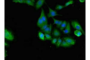 Immunofluorescent analysis of Hela cells using ABIN7158098 at dilution of 1:100 and Alexa Fluor 488-congugated AffiniPure Goat Anti-Rabbit IgG(H+L)