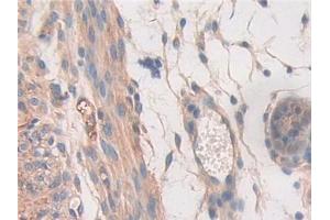 DAB staining on IHC-P; Samples: Mouse Uterus Tissue (STAT2 anticorps  (AA 658-912))