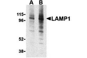 Western Blotting (WB) image for anti-Lysosomal-Associated Membrane Protein 1 (LAMP1) (Middle Region) antibody (ABIN1030977) (LAMP1 anticorps  (Middle Region))