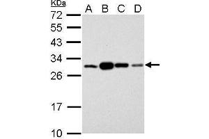 WB Image 14-3-3 sigma antibody detects SFN protein by Western blot analysis.