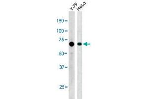 The RAD9A (phospho S387) polyclonal antibody  is used in Western blot to detect Phospho-RAD9A-S387 in Y-79 (left) and Hela (right) cell lysate. (RAD9A anticorps  (pSer387))
