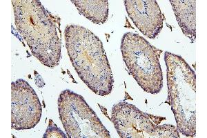 IHC analysis of BUB1B using anti-BUB1B antibody (ABIN7600962). (BUB1B anticorps  (AA 26-448))