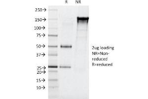 SDS-PAGE Analysis Purified CELA3B Mouse Monoclonal Antibody (CELA3B/1257).