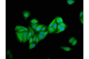 Immunofluorescence staining of HepG2 cells with ABIN7162698 at 1:166, counter-stained with DAPI. (PNPLA5 anticorps  (AA 90-205))