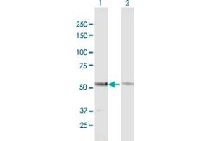 Western Blot analysis of GTF2E1 expression in transfected 293T cell line by GTF2E1 MaxPab polyclonal antibody.