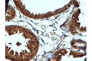 Immunohistochemical staining of paraffin-embedded Human breast tissue using anti-C2orf56 mouse monoclonal antibody. (NDUFAF7 anticorps)