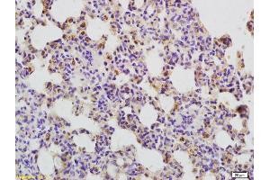 Formalin-fixed and paraffin embedded rat lung labeled with Anti-CD134 Polyclonal Antibody, Unconjugated (ABIN749108) at 1:200 followed by conjugation to the secondary antibody and DAB staining
