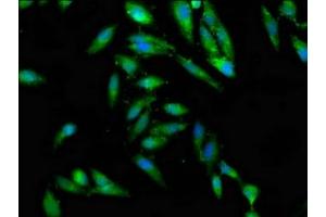 Immunofluorescence staining of Hela cells with ABIN7147441 at 1:100, counter-stained with DAPI. (CEP97 anticorps  (AA 719-854))