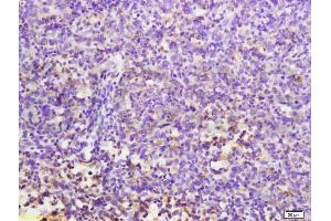 Formalin-fixed and paraffin embedded mouse lymphoma labeled with Anti-MuRF1/Trim63 Polyclonal Antibody, Unconjugated (ABIN687697) at 1:200 followed by conjugation to the secondary antibody and DAB staining. (CD7 anticorps  (AA 181-240))