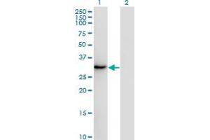 Western Blot analysis of SSX2 expression in transfected 293T cell line by SSX2 monoclonal antibody (M01), clone 1A4. (SSX2 anticorps  (AA 1-223))
