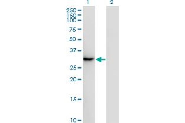 SSX2 Antikörper  (AA 1-223)