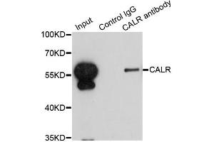 Immunoprecipitation analysis of 200ug extracts of HepG2 cells using 1ug CALR antibody. (Calreticulin anticorps)