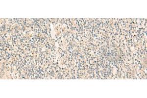 Immunohistochemistry of paraffin-embedded Human tonsil tissue using NGEF Polyclonal Antibody at dilution of 1:35(x200) (NGEF anticorps)
