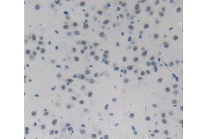 IHC-P analysis of Kidney tissue, with DAB staining. (NUP214 anticorps  (AA 601-868))