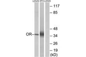 Western Blotting (WB) image for anti-Olfactory Receptor, Family 4, Subfamily D, Member 6 (OR4D6) (AA 260-309) antibody (ABIN2891007) (OR4D6 anticorps  (AA 260-309))