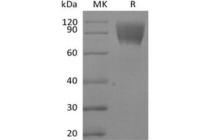 Western Blotting (WB) image for Mucin 16, Cell Surface Associated (CA125) protein (Biotin) (ABIN7319819) (MUC16 Protein (Biotin))