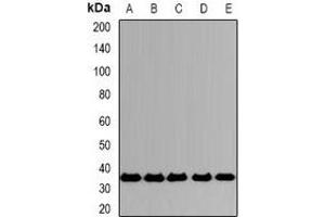 Western blot analysis of CD319 expression in A549 (A), SKOV3 (B), mouse spleen (C), mouse lung (D), rat testis (E) whole cell lysates. (SLAMF7 anticorps)