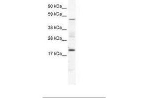 Image no. 1 for anti-Casein Kinase 1, gamma 1 (CSNK1G1) (AA 279-328) antibody (ABIN202567) (CSNK1G1 anticorps  (AA 279-328))