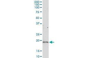 RNF181 (Human) IP-WB Antibody Pair