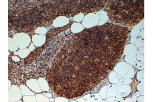 ABIN185069 (4µg/ml) staining of paraffin embedded Human Thymus. (FOXN1 anticorps  (C-Term))