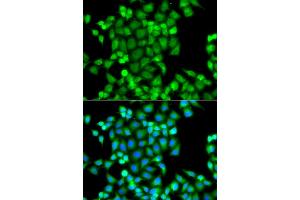 Immunofluorescence analysis of A549 cells using PAK2 antibody. (PAK2 anticorps)