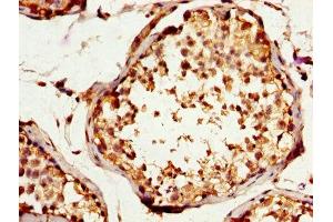 IHC image of ABIN7170472 diluted at 1:200 and staining in paraffin-embedded human testis tissue performed on a Leica BondTM system.