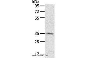 Western blot analysis of A431 cell, using PDLIM4 Polyclonal Antibody at dilution of 1:400 (PDLIM4 anticorps)