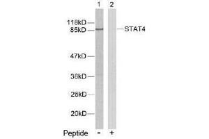Image no. 2 for anti-Signal Transducer and Activator of Transcription 4 (STAT4) (Tyr693) antibody (ABIN197179) (STAT4 anticorps  (Tyr693))