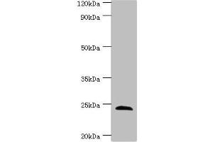 Western blot All lanes: SOST antibody at 4 μg/mL + Hela whole cell lysate Secondary Goat polyclonal to rabbit IgG at 1/10000 dilution Predicted band size: 24 kDa Observed band size: 24 kDa (Sclerostin anticorps  (AA 24-213))