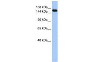 Image no. 1 for anti-Ubiquitin Protein Ligase E3A (ube3a) (C-Term) antibody (ABIN6743133) (ube3a anticorps  (C-Term))