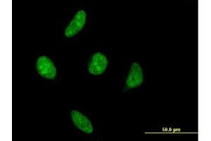 Immunofluorescence of monoclonal antibody to VRK1 on HeLa cell.