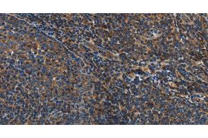 Immunohistochemistry of paraffin-embedded Human tonsil tissue using IL17D Polyclonal Antibody at dilution 1:50