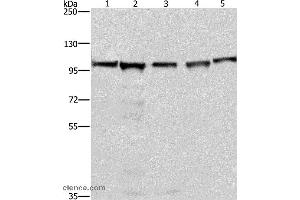 Western blot analysis of 293T, A549, Raji, K562 and NIH/3T3 cell, using MCM6 Polyclonal Antibody at dilution of 1:433. (MCM6 anticorps)